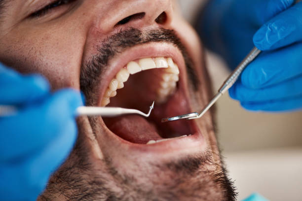 Best Emergency Denture Repair in Heyworth, IL
